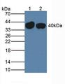 SERPINA7 / TBG Antibody - Western Blot; Sample: Lane1: Mouse Liver Tissue; Lane2: Rat Liver Tissue.