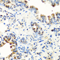 SERPINA7 / TBG Antibody - Immunohistochemistry of paraffin-embedded mouse lung tissue.