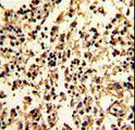 SERPINA9 Antibody - Formalin-fixed and paraffin-embedded human lymph with SERPINA9 Antibody , which was peroxidase-conjugated to the secondary antibody, followed by DAB staining. This data demonstrates the use of this antibody for immunohistochemistry; clinical relevance has not been evaluated.