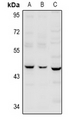 SERPINB12 Antibody - Western blot analysis of Serpin B12 expression in A549 (A), LO2 (B), AML12 (C) whole cell lysates.