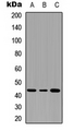Antibody - Western blot analysis of Serpin B3/4 expression in THP1 (A); NS-1 (B); PC12 (C) whole cell lysates.