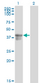SERPINB3 Antibody - Western Blot analysis of SERPINB3 expression in transfected 293T cell line by SERPINB3 monoclonal antibody (M01), clone 2F5.Lane 1: SERPINB3 transfected lysate(44.6 KDa).Lane 2: Non-transfected lysate.