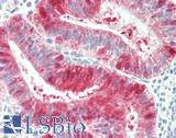 SERPINB9 / PI9 Antibody - Human Uterus: Formalin-Fixed, Paraffin-Embedded (FFPE)