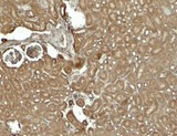 SESN2 / HI95 Antibody - Immunohistochemistry of SESTRIN2 in mouse kidney tissue with SESTRIN2 antibody at 5 ug/ml.