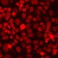SETD2 Antibody - Immunofluorescent staining of A549 cells.
