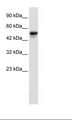 SETD4 Antibody - HepG2 Cell Lysate.  This image was taken for the unconjugated form of this product. Other forms have not been tested.