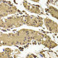 SETD5 Antibody - Immunohistochemistry of paraffin-embedded human stomach tissue.