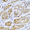 SETD5 Antibody - Immunohistochemical analysis of SETD5 staining in human stomach formalin fixed paraffin embedded tissue section. The section was pre-treated using heat mediated antigen retrieval with sodium citrate buffer (pH 6.0). The section was then incubated with the antibody at room temperature and detected using an HRP conjugated compact polymer system. DAB was used as the chromogen. The section was then counterstained with hematoxylin and mounted with DPX.