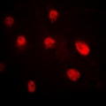 SETD8 / SET8 Antibody - Immunofluorescent analysis of Pr-Set7 staining in MCF7 cells. Formalin-fixed cells were permeabilized with 0.1% Triton X-100 in TBS for 5-10 minutes and blocked with 3% BSA-PBS for 30 minutes at room temperature. Cells were probed with the primary antibody in 3% BSA-PBS and incubated overnight at 4 deg C in a humidified chamber. Cells were washed with PBST and incubated with a DyLight 594-conjugated secondary antibody (red) in PBS at room temperature in the dark.