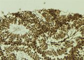 SETDB2 Antibody - 1:100 staining mouse testis tissue by IHC-P. The sample was formaldehyde fixed and a heat mediated antigen retrieval step in citrate buffer was performed. The sample was then blocked and incubated with the antibody for 1.5 hours at 22°C. An HRP conjugated goat anti-rabbit antibody was used as the secondary.