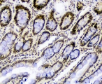 SF1 Antibody - IHC analysis of splicing factor 1 using anti-splicing factor 1 antibody. splicing factor 1 was detected in paraffin-embedded section of rat small intestine tissue. Heat mediated antigen retrieval was performed in citrate buffer (pH6, epitope retrieval solution) for 20 mins. The tissue section was blocked with 10% goat serum. The tissue section was then incubated with 1µg/ml rabbit anti-splicing factor 1 Antibody overnight at 4°C. Biotinylated goat anti-rabbit IgG was used as secondary antibody and incubated for 30 minutes at 37°C. The tissue section was developed using Strepavidin-Biotin-Complex (SABC) with DAB as the chromogen.