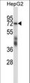 SF1 Antibody - SF1 Antibody western blot of HepG2 cell line lysates (35 ug/lane). The SF1 antibody detected the SF1 protein (arrow).