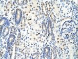 SF1 Antibody - SF1 antibody ARP41214_T100-NP_004621-SF1 (splicing factor 1) Antibody was used in IHC to stain formalin-fixed, paraffin-embedded human kidney.  This image was taken for the unconjugated form of this product. Other forms have not been tested.