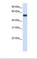 SF3A3 / SF3a60 Antibody - Fetal muscle lysate. Antibody concentration: 1.0 ug/ml. Gel concentration: 12%.  This image was taken for the unconjugated form of this product. Other forms have not been tested.