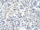 SF3B6 / SF3B14 Antibody - SF3B1 antibody ARP40248_T100-AAH56155-SF3B1 (splicing factor 3b, subunit 1, 155kDa) Antibody was used in IHC to stain formalin-fixed, paraffin-embedded human liver.  This image was taken for the unconjugated form of this product. Other forms have not been tested.