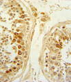 SFRP1 Antibody - Formalin-fixed and paraffin-embedded human testis tissue reacted with SFRP1 Antibody , which was peroxidase-conjugated to the secondary antibody, followed by DAB staining. This data demonstrates the use of this antibody for immunohistochemistry; clinical relevance has not been evaluated.