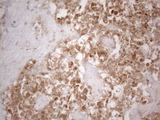 SFRP2 Antibody - Immunohistochemical staining of paraffin-embedded Human liver tissue within the normal limits using anti-SFRP2 mouse monoclonal antibody. (Heat-induced epitope retrieval by 1mM EDTA in 10mM Tris buffer. (pH8.5) at 120°C for 3 min. (1:150)