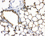 SFTPA1 / Surfactant Protein A Antibody - IHC analysis of SFTPA1 using anti-SFTPA1 antibody. SFTPA1 was detected in paraffin-embedded section of mouse lung tissues. Heat mediated antigen retrieval was performed in citrate buffer (pH6, epitope retrieval solution) for 20 mins. The tissue section was blocked with 10% goat serum. The tissue section was then incubated with 1µg/ml rabbit anti-SFTPA1 Antibody overnight at 4°C. Biotinylated goat anti-rabbit IgG was used as secondary antibody and incubated for 30 minutes at 37°C. The tissue section was developed using Strepavidin-Biotin-Complex (SABC) with DAB as the chromogen.