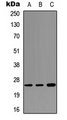 SFTPA1 / Surfactant Protein A Antibody - Western blot analysis of SFTPA1 expression in HEK293T (A); NS-1 (B); PC12 (C) whole cell lysates.