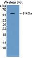 SFTPC / Surfactant Protein C Antibody - Western blot of SFTPC / Surfactant Protein C antibody.