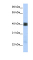 SGCB / SGC / Sarcoglycan Beta Antibody - SGCB antibody Western blot of Fetal Heart lysate. This image was taken for the unconjugated form of this product. Other forms have not been tested.