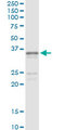SGCG / Gamma-Sarcoglycan Antibody - Immunoprecipitation of SGCG transfected lysate using anti-SGCG monoclonal antibody and Protein A Magnetic Bead, and immunoblotted with SGCG rabbit polyclonal antibody.
