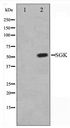 SGK1 / SGK Antibody - Western blot of SGK expression in Jurkat whole cell lysates,The lane on the left is treated with the antigen-specific peptide.