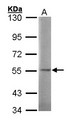 SGSH Antibody - Sample (30 ug of whole cell lysate). A: 293T. 7.5% SDS PAGE. SGSH antibody diluted at 1:1000. 