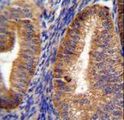 SGSM2 Antibody - RUTBC1 Antibody immunohistochemistry of formalin-fixed and paraffin-embedded human uterus tissue followed by peroxidase-conjugated secondary antibody and DAB staining.