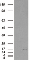 SH2D1A / SAP Antibody - HEK293 overexpressing SH2D1A (RC204723) and probed with (mock transfection in first lane).