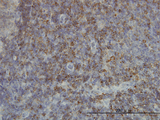 SH2D3C / NSP3 Antibody - Immunoperoxidase of monoclonal antibody to SH2D3C on formalin-fixed paraffin-embedded human lymph node. [antibody concentration 3 ug/ml]