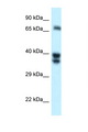 SH3BP1 Antibody - SH3BP1 antibody Western blot of 721_B Cell lysate. Antibody concentration 1 ug/ml.  This image was taken for the unconjugated form of this product. Other forms have not been tested.