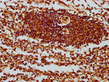 SH3BP1 Antibody - Immunohistochemistry Dilution at 1:400 and staining in paraffin-embedded human spleen tissue performed on a Leica BondTM system. After dewaxing and hydration, antigen retrieval was mediated by high pressure in a citrate buffer (pH 6.0). Section was blocked with 10% normal Goat serum 30min at RT. Then primary antibody (1% BSA) was incubated at 4°C overnight. The primary is detected by a biotinylated Secondary antibody and visualized using an HRP conjugated SP system.