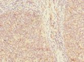 SH3D19 Antibody - Immunohistochemistry of paraffin-embedded human tonsil tissue using SH3D19 Antibody at dilution of 1:100