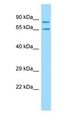 SH3KBP1 / CIN85 Antibody - SH3KBP1 / CIN85 antibody Western Blot of Rat Thymus.  This image was taken for the unconjugated form of this product. Other forms have not been tested.