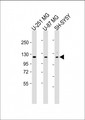 SH3PXD2B Antibody - All lanes: Anti-SH3PXD2B Antibody (C-Term) at 1:2000 dilution Lane 1: U-251 MG whole cell lysate Lane 2: U-87 MG whole cell lysate Lane 3: SH-SY5Y whole cell lysate Lysates/proteins at 20 µg per lane. Secondary Goat Anti-Rabbit IgG, (H+L), Peroxidase conjugated at 1/10000 dilution. Predicted band size: 102 kDa Blocking/Dilution buffer: 5% NFDM/TBST.