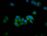 SH3RF1 / POSH Antibody - Immunofluorescence staining of Hela cells diluted at 1:200, counter-stained with DAPI. The cells were fixed in 4% formaldehyde, permeabilized using 0.2% Triton X-100 and blocked in 10% normal Goat Serum. The cells were then incubated with the antibody overnight at 4°C.The Secondary antibody was Alexa Fluor 488-congugated AffiniPure Goat Anti-Rabbit IgG (H+L).