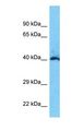 SH3YL1 Antibody - Western blot of SH3YL1 Antibody with human Fetal Lung lysate.  This image was taken for the unconjugated form of this product. Other forms have not been tested.