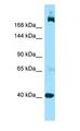 SHANK2 / SHANK Antibody - SHANK2 / SHANK antibody Western Blot of Jurkat.  This image was taken for the unconjugated form of this product. Other forms have not been tested.
