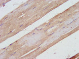 SHARPIN Antibody - Immunohistochemistry image at a dilution of 1:500 and staining in paraffin-embedded human skeletal muscle tissue performed on a Leica BondTM system. After dewaxing and hydration, antigen retrieval was mediated by high pressure in a citrate buffer (pH 6.0) . Section was blocked with 10% normal goat serum 30min at RT. Then primary antibody (1% BSA) was incubated at 4 °C overnight. The primary is detected by a biotinylated secondary antibody and visualized using an HRP conjugated SP system.
