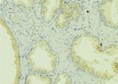 SHARPIN Antibody - 1:100 staining mouse colon tissue by IHC-P. The sample was formaldehyde fixed and a heat mediated antigen retrieval step in citrate buffer was performed. The sample was then blocked and incubated with the antibody for 1.5 hours at 22°C. An HRP conjugated goat anti-rabbit antibody was used as the secondary.