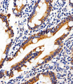 SHB Antibody - Immunohistochemical of paraffin-embedded H. small intestine section using Phospho-HUMAN-SHB (Y268). control. Antibody was diluted at 1:25 dilution. A peroxidase-conjugated goat anti-rabbit IgG at 1:400 dilution was used as the secondary antibody, followed by DAB staining.