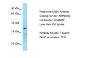 SHBG Antibody -  This image was taken for the unconjugated form of this product. Other forms have not been tested.