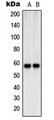 SHC2 / SLI Antibody - Western blot analysis of SHCB expression in Jurkat (A); NIH3T3 (B) whole cell lysates.
