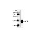 Shiga-Like Toxin 1 Subunit A Antibody