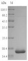 60 kDa chaperonin Protein - (Tris-Glycine gel) Discontinuous SDS-PAGE (reduced) with 5% enrichment gel and 15% separation gel.