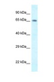 SHKBP1 Antibody - SHKBP1 antibody Western blot of Mouse Pancreas lysate. Antibody concentration 1 ug/ml.  This image was taken for the unconjugated form of this product. Other forms have not been tested.