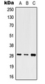 SHOX Antibody - Western blot analysis of SHOX expression in HEK293T (A); Raw264.7 (B); SP2/0 (C) whole cell lysates.