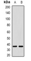 SHOX2 Antibody - Western blot analysis of SHOX2 expression in NIH3T3 (A); mouse liver (B) whole cell lysates.