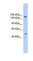 SHPRH Antibody - SHPRH antibody Western blot of HeLa lysate. This image was taken for the unconjugated form of this product. Other forms have not been tested.